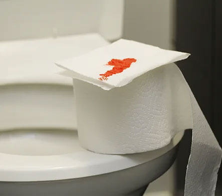 Intermittent Bleeding