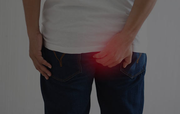Fissure Treatment in Delhi