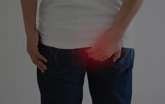 Fissure Treatment in Delhi