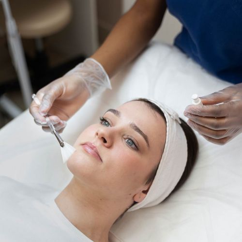 Chemical Peel Treatment in Delhi